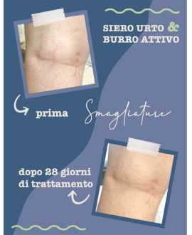 Anti-Stretch Mark Serum - Organic